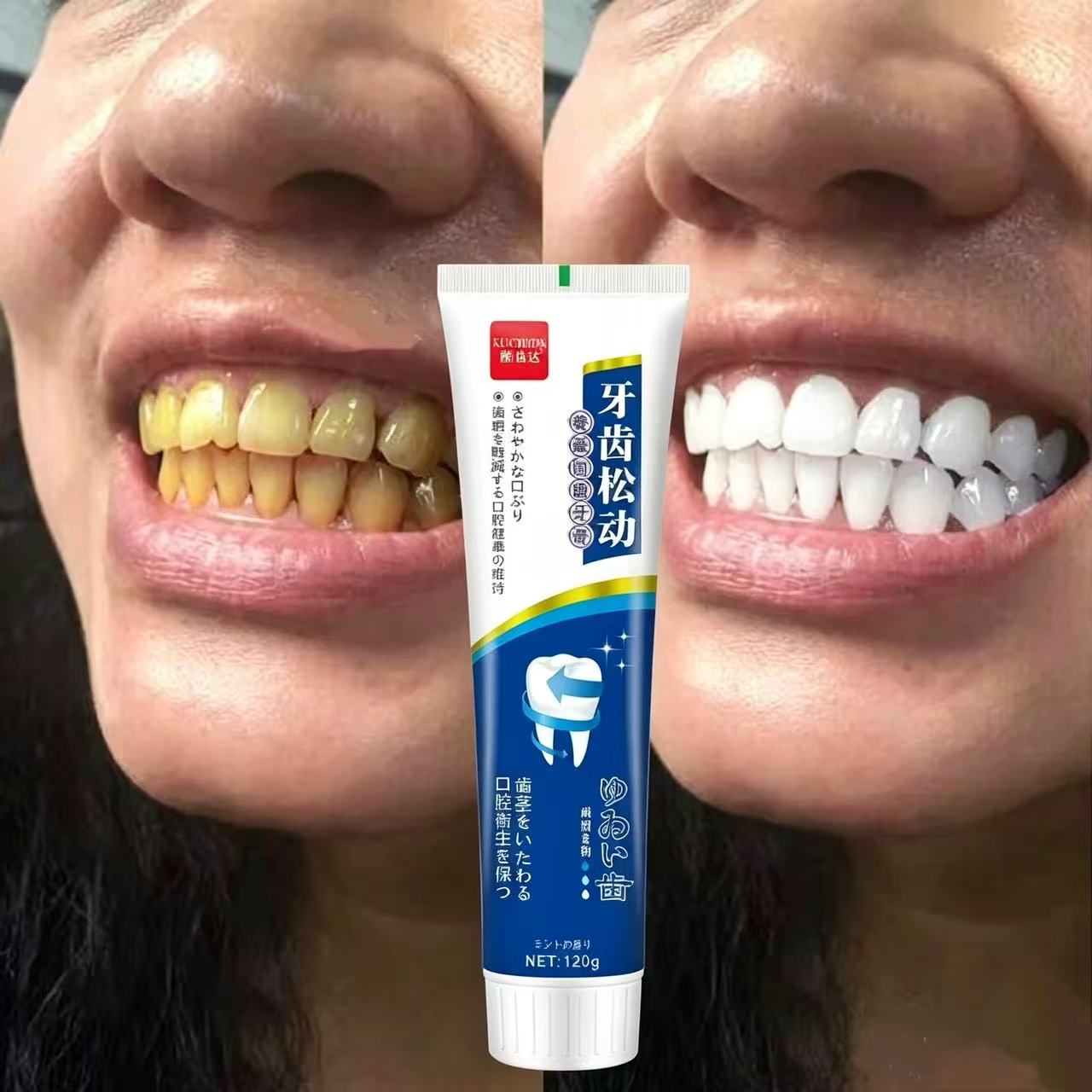 Teeth Whitening Japan - ゆるんだ歯を補修する 日本輸入歯磨き粉 一年中使える口腔ケア 大人用 男女兼用 ホワイトニング