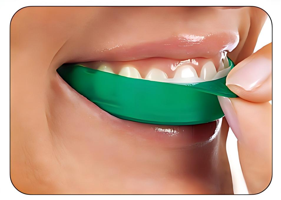 Teeth Whitening Opalescence Go - ウルトラデント オパレスセンス ゴー ホワイトニングストリップス 6% HP