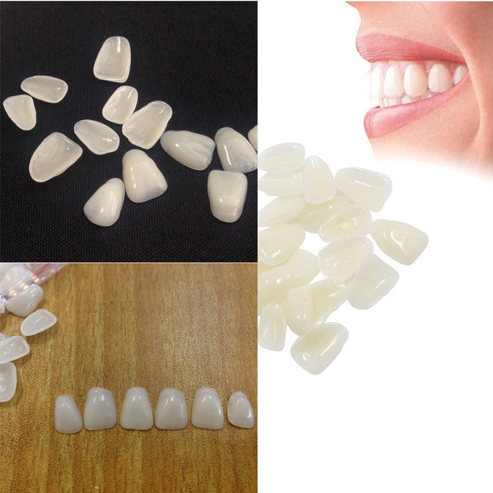 Teeth Whitening Kit Professional - 超薄型の歯のホワイトニングベニア,樹脂製の歯,前上部,ホット,パッケージあたり70個