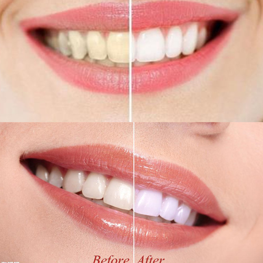 竹炭歯,口腔衛生,煙のホワイトニング,新鮮な呼吸のための歯の - Teeth Whitening Flash のレビューと価格