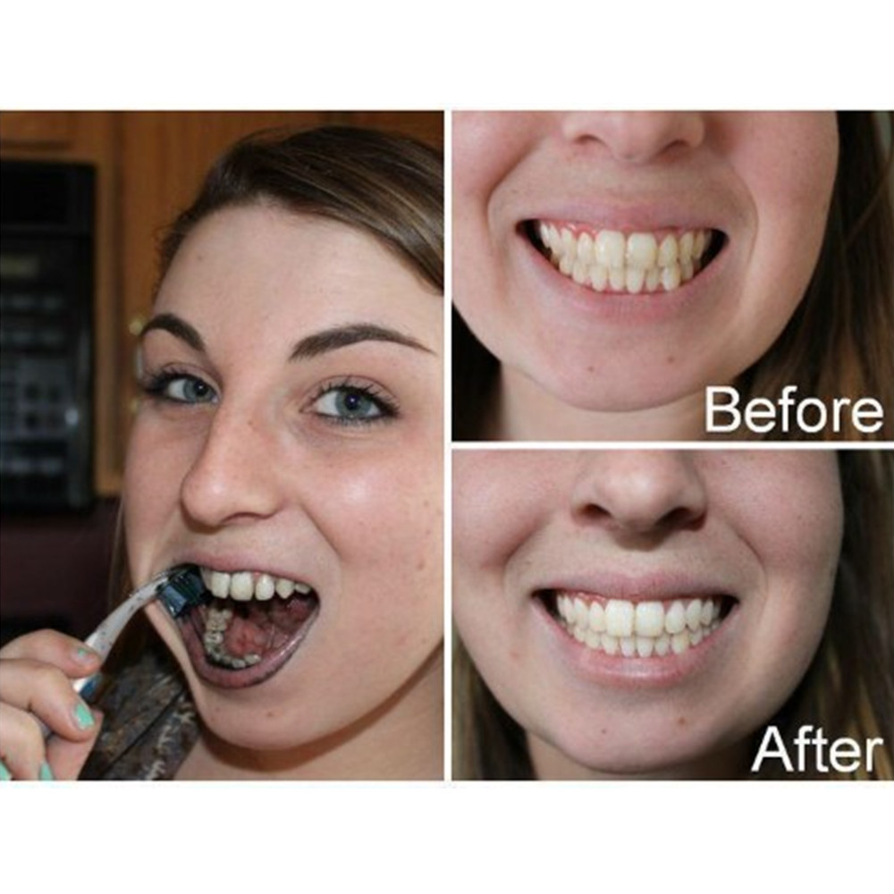 竹炭歯,口腔衛生,煙のホワイトニング,新鮮な呼吸のための歯の - Teeth Whitening Flash のレビューと価格