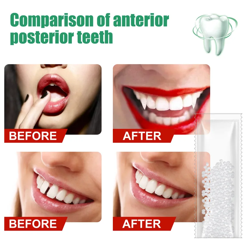 10g50g/30 ミリリットル樹脂歯の修復接着剤成形可能な - Teeth Whitening At Home のレビューと価格