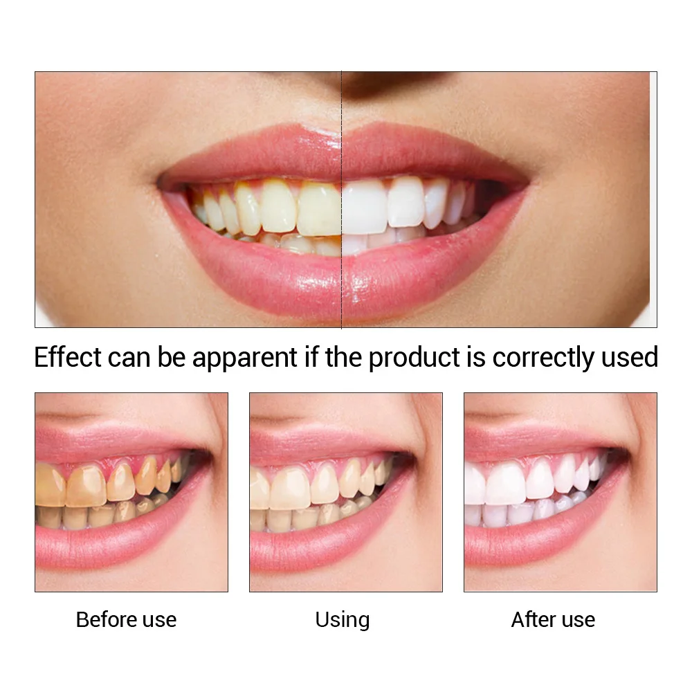 歯のホワイトニングエッセンス,口腔衛生,歯のホワイトニング, - Teeth Whitening Flash のレビューと価格