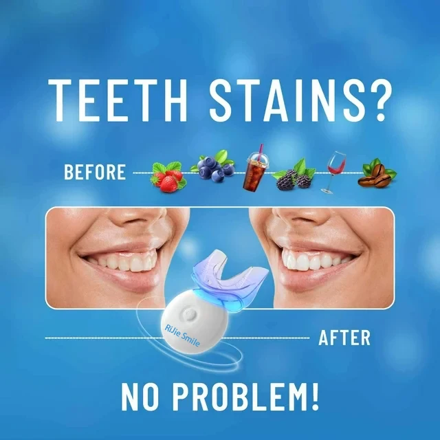 高品質クリーニングキット ワイヤレスホワイトニングデバイス  - Teeth Whitening Kit At Home のレビューと価格
