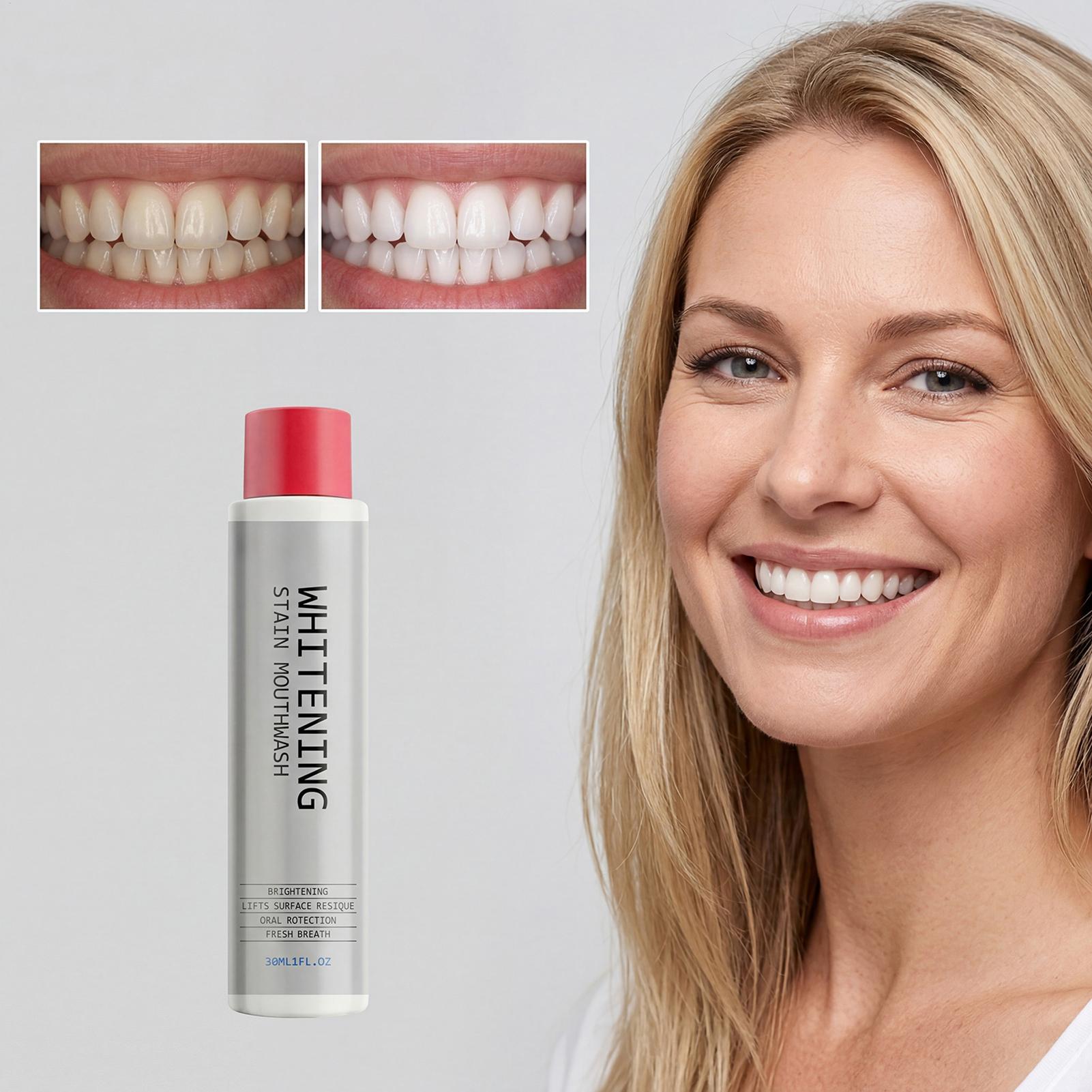 30ml ステインホワイトニングマウスウォッシュ、臭いを除去 - Teeth Whitening Kit Professional のレビューと価格