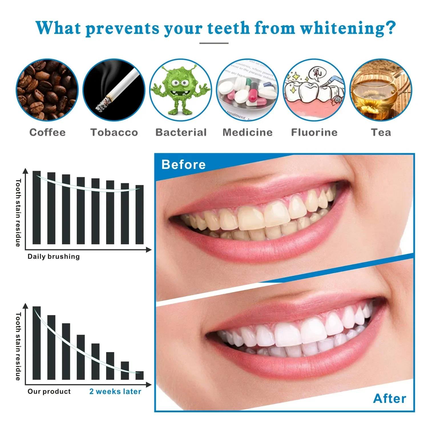 14/28 個 3D 歯ホワイトニングストリップ聖霊降臨祭プ - Whitening Strip 3D のレビューと価格